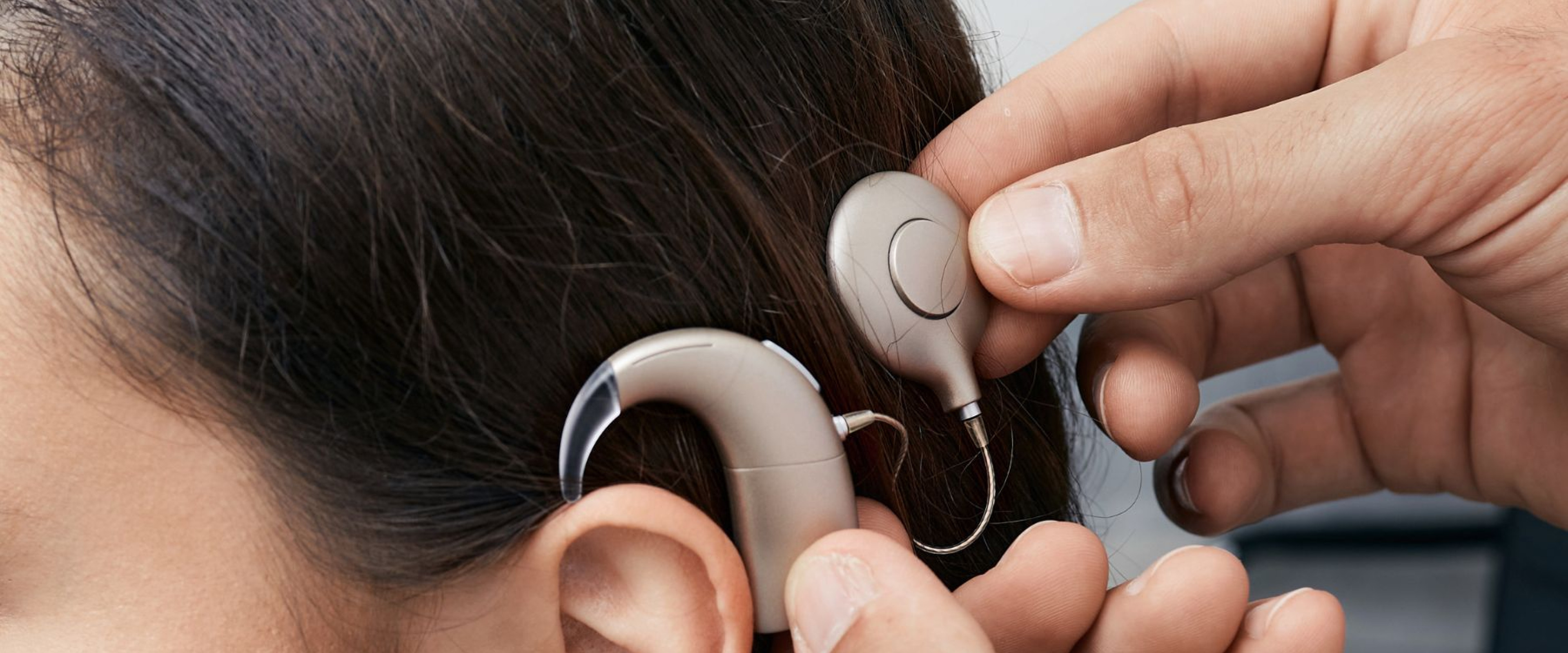 cochlear implant